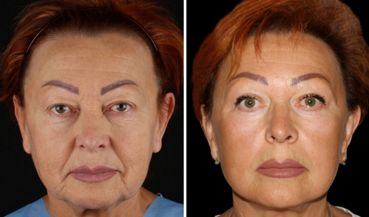 ​best facial plastic surgeon in sacramento